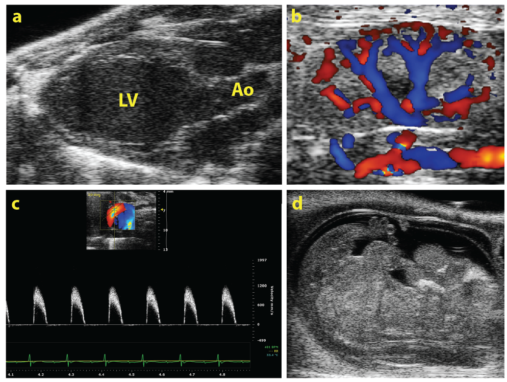 Heart Monitoring ECGenie