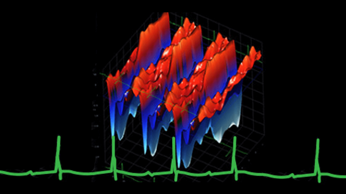 Cardiovascular