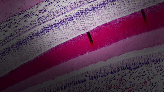Histopathology
