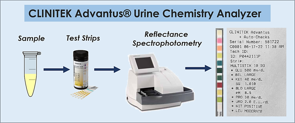 Urine Chemistry analyses scheme